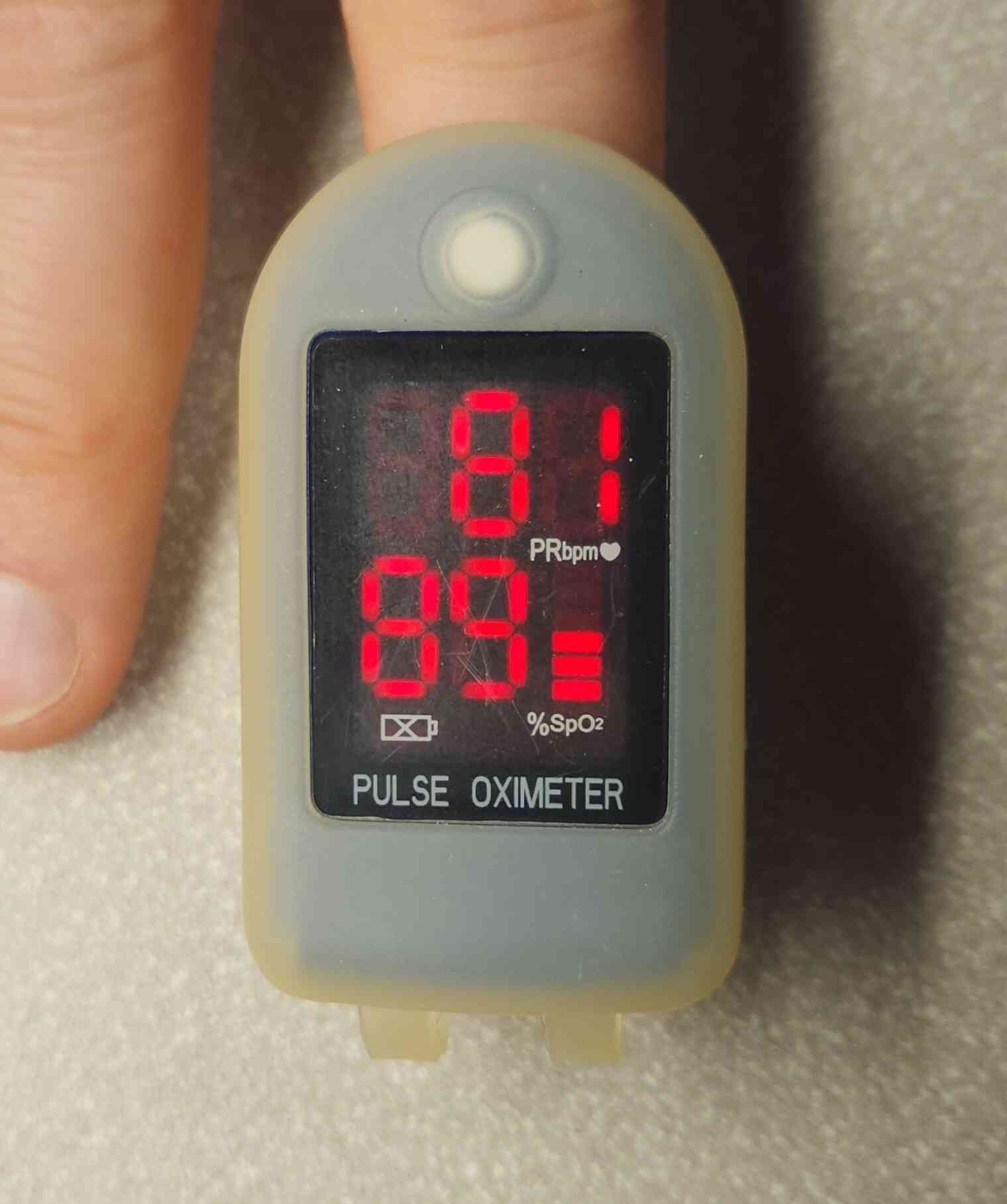 Pulse Oximeter